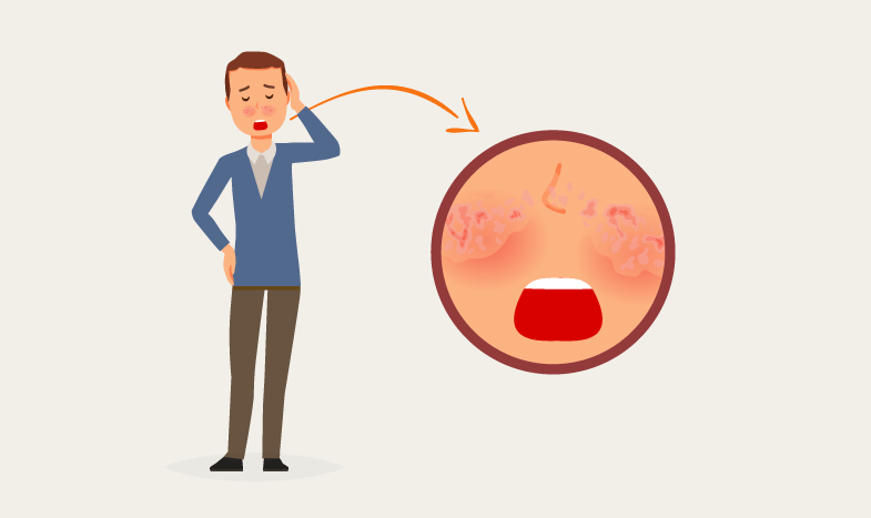 rosacea