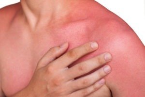 Doenças típicas durante o verão